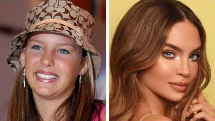 Belinda before and after plastic surgeries