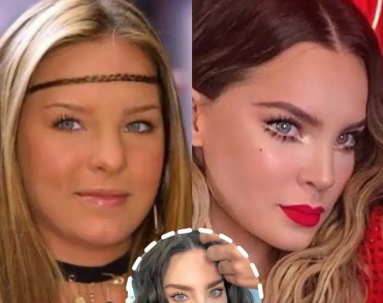 Belinda before and after plastic surgeries, did it change a lot? 1 Belinda before and after plastic surgeries
