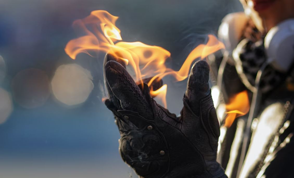 If You Recently Suffered a Serious Burn Injury Here's What To Do