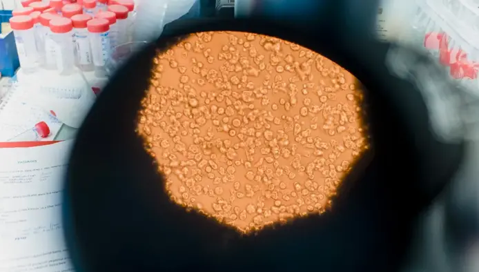 What is the zombie virus? Can it infect humans? See photos of the research that discovered the pathogens 1 Zombie virus sample captured by microscope in the research lab
